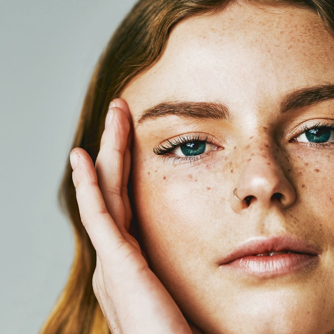 A MODEL WITH FRECKLES